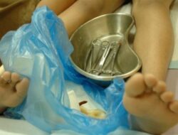 Sunat Perempuan: Praktik dan Pandangan di Indonesia