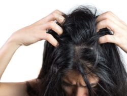 8 Penyebab Ketombe pada Rambut dan Kulit Kepala: Penjelasan Komprehensif
